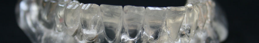 Progettazione e Realizzazione Dime Chirurgiche