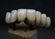 Gruppo Frontale in Zirconio 3