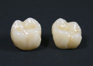 Ceramica Metalfree 1