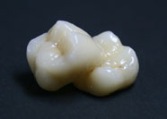 Ceramica Metalfree 3