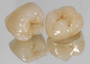 Ceramica Metalfree 4