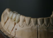 Ceramica Tradizionale 2