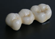 Ceramica Tradizionale 3