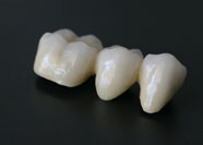 Ceramica Tradizionale 4