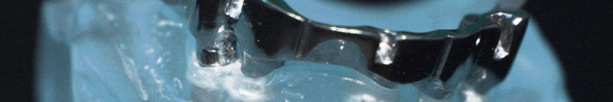 Laboratorio Odontoiatrico - Nuove Tecnologie