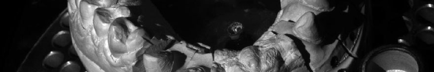 Restauri Dentali in Zirconia