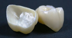 Zirconio Ceramica
